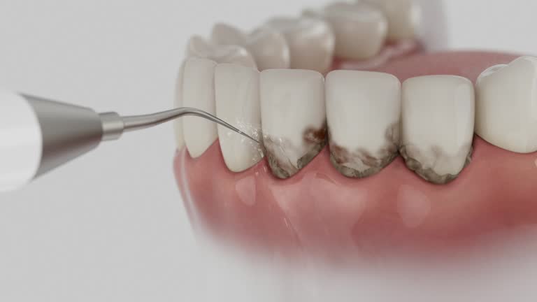 Reliable Dental contractor in Perryman, MD by Smile Center Dentistry